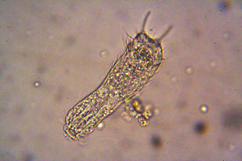 gastrotrico del muschio